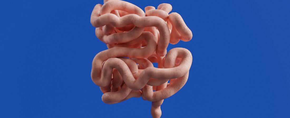 Inflamación intestinal: causas, síntomas y cómo reducirla de forma natural