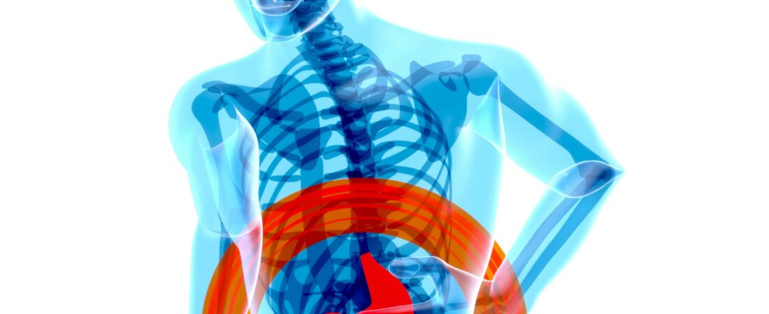 Colon irritable y SIBO: ¿son lo mismo o condiciones diferentes?