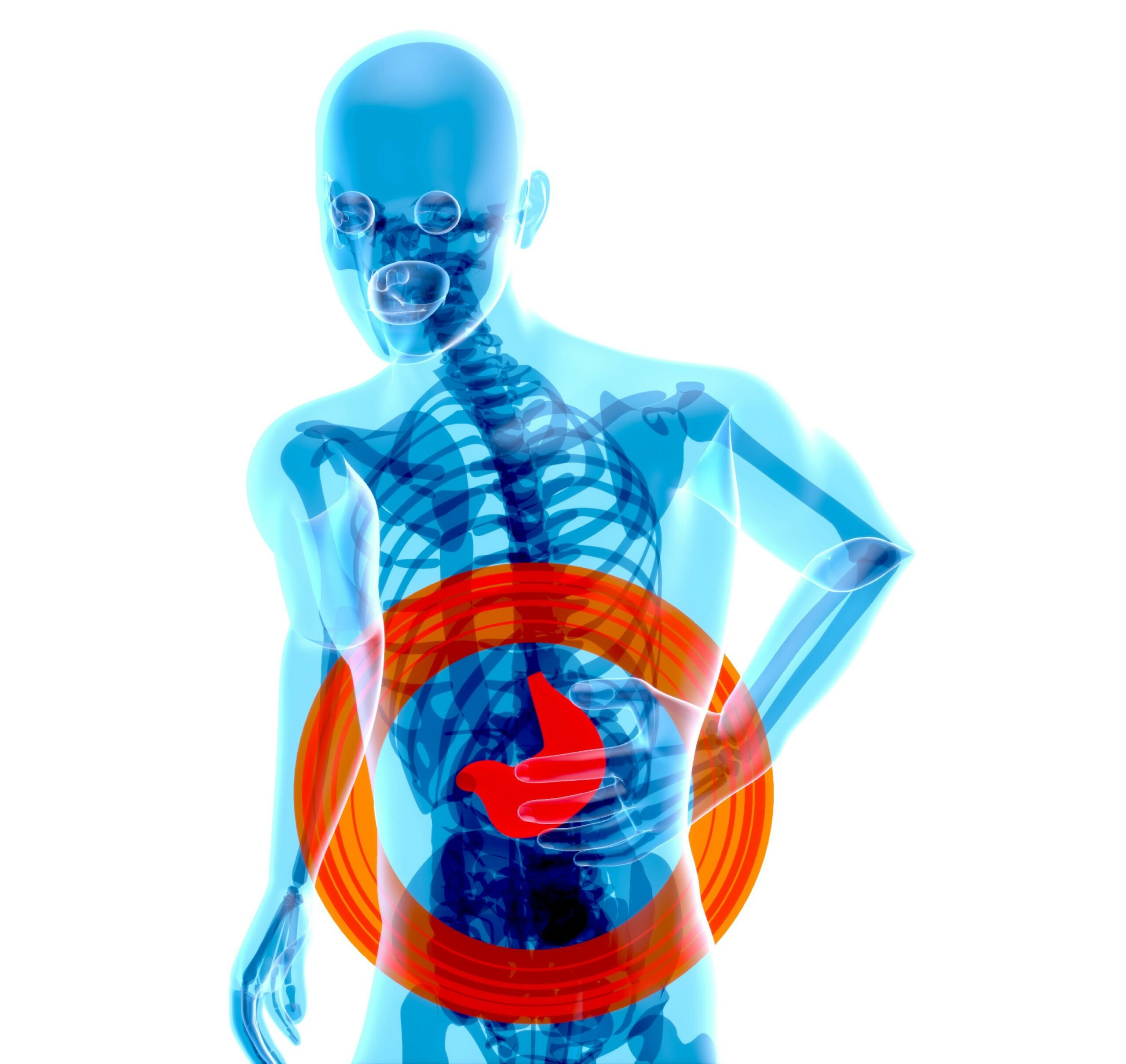 Colon irritable y SIBO: ¿son lo mismo o condiciones diferentes?